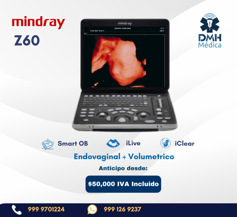 Equipo de ultrasonido Mindray Z6/Z60