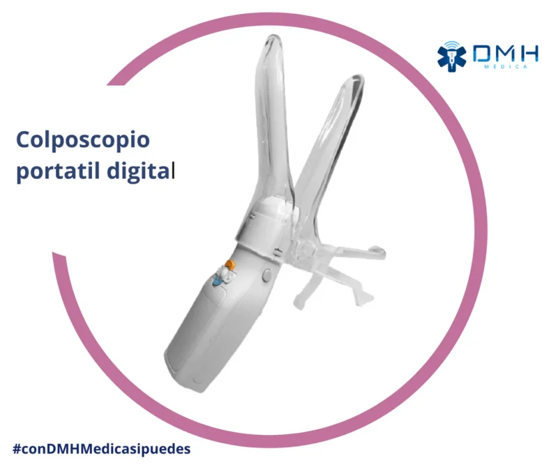 Colposcopio- Mini digital portatil